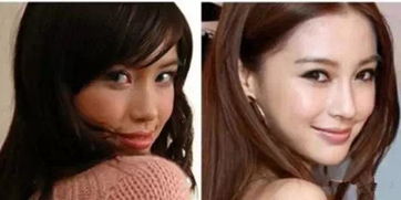 angelababy整容之前的照片杨紫的脸还能撑几年(angelababy整容前什么样子)