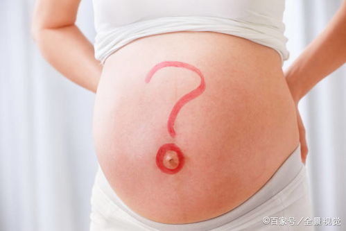 医生花式暗示胎儿性别的几大类型 或隐晦或逗比,你捕捉到了吗