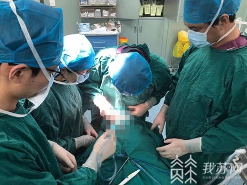 挑战极限 南京儿医团队完成两月龄患儿动脉上恶性血管瘤切除手术