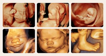 胎儿四维彩超图像(胎儿四维彩超图像看男女)