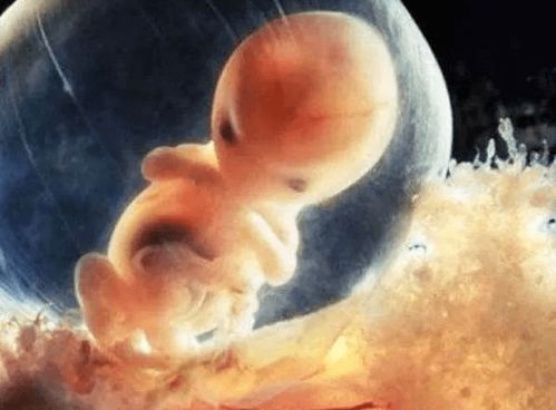 胚胎可以称为胎宝宝了,孕妈妈的妊娠反应仍在继续