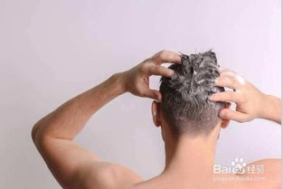 男性脱发严重,洗头掉头发处理经验和防脱方法