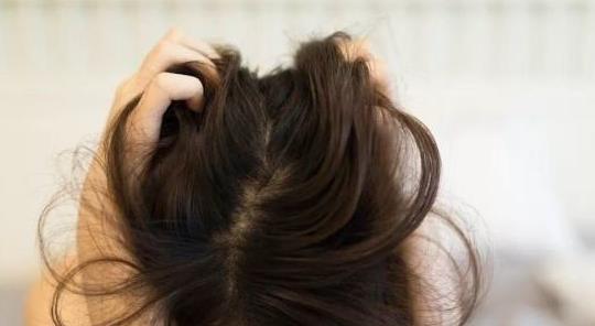女性掉发严重就吃它,养发护发,强过生发剂,再不怕掉发